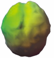 脳スキャン画像2