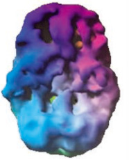 脳スキャン画像3